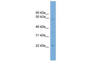 Western Blot showing EHD1 antibody used at a concentration of 1-2 ug/ml to detect its target protein. (EHD1 antibody  (Middle Region))