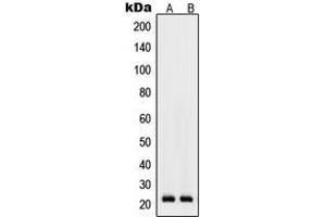 Western blot analysis of RhoD expression in K562 (A), Raw264. (RHOD antibody  (Center))