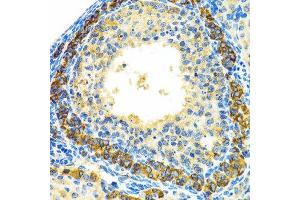Immunohistochemistry of paraffin-embedded rat ovary using MRPL28 antibody. (MRPL28 antibody  (AA 1-256))
