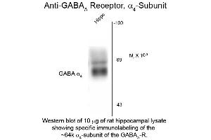 Western Blot of Anti-GABA(A) Receptor alpha 4 (Rabbit) Antibody - 612-401-D47 Western Blot of Anti-GABA(A) Receptor alpha 4 (Rabbit) Antibody. (GABRA4 antibody  (Cytoplasmic Loop))