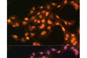 Immunofluorescence analysis of C6 cells using Snail Polyclonal Antibody at dilution of 1:100. (SNAIL antibody)