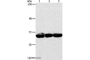 Western blot analysis of 293T, hepG2 and A549 cell, using CKAP4 Polyclonal Antibody at dilution of 1:750 (CKAP4 antibody)