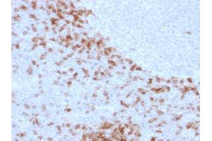 Formalin-fixed, paraffin-embedded human Lymph Node stained with IgD Mouse Monoclonal Antibody (IGD26). (IgD antibody)