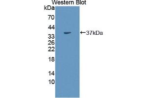Western blot analysis of the recombinant protein. (CA8 antibody  (AA 1-290))