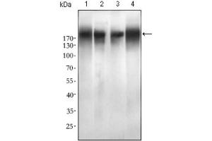 Western blot analysis using EGFR mutant antibody against SPC-A-1 (1), A549 (2), HepG2 (3) and MCF-7 (4) cell lysate. (EGFR Mutant (AA 693-893), (Mutant) antibody)
