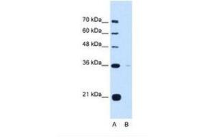Image no. 1 for anti-Torsin Family 1, Member B (Torsin B) (TOR1B) (AA 251-300) antibody (ABIN321197) (TOR1B antibody  (AA 251-300))