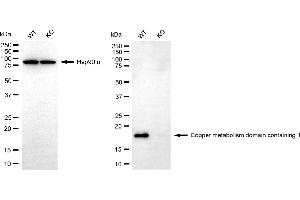 Western blotting analysis using copper metabolism domain containing 1 antibody (ABIN7798154).