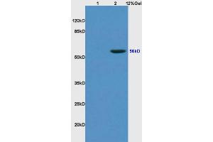 L1 rat kidney lysates L2 human colon carcinoma lysates probed with Anti KLF4 Polyclonal Antibody, Unconjugated (ABIN737121) at 1:200 overnight at 4 °C. (KLF2/4 antibody  (AA 415-513))