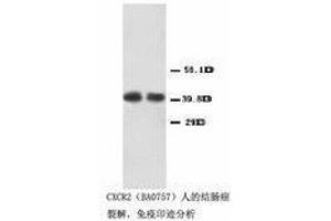 Image no. 1 for anti-Chemokine (C-X-C Motif) Receptor 2 (CXCR2) (Internal Region) antibody (ABIN1490393) (CXCR2 antibody  (Internal Region))
