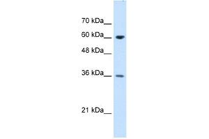 WB Suggested Anti-STIP1 Antibody Titration:  1. (STIP1 antibody  (N-Term))