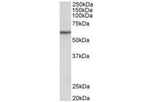 Antibody (1µg/ml) staining of Human Breast cancer lysate (35µg protein in RIPA buffer).