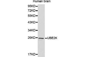 Western Blotting (WB) image for anti-Ubiquitin-Conjugating Enzyme E2K (UBE2K) (AA 1-100) antibody (ABIN3021403) (UBE2K antibody  (AA 1-100))