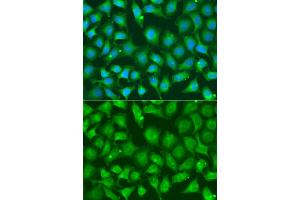 Immunofluorescence analysis of A549 cells using XRCC2 antibody. (XRCC2 antibody)