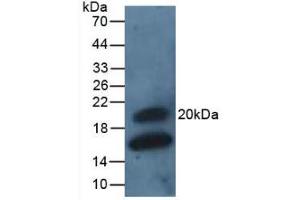 Figure. (GREM1 antibody  (AA 26-184))