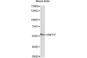 Western blot analysis of extracts of mouse testis, using ZNF177 antibody. (ZNF177 antibody)