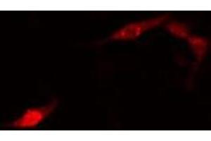 ABIN6275774 staining HuvEc cells by IF/ICC. (IGF2BP2 antibody  (C-Term))