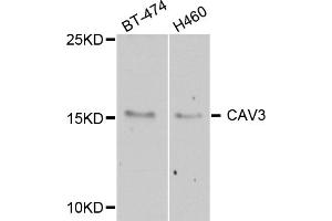 Western blot analysis of extracts of various cell lines, using CAV3 antibody (ABIN5974782) at 1/1000 dilution. (Caveolin 3 antibody)