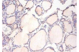 Immunohistochemistry of paraffin-embedded human thyroid tissue using ABIN7150042 at dilution of 1:100 (ADAM15 antibody  (AA 207-452))