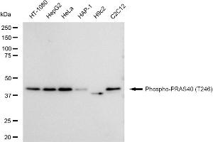 Western blotting analysis using Phospho-PRAS40 (T246) antibody (ABIN7797545).