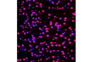 Immunofluorescence of paraffin embedded mouse brain using smad62024 (ABIN7075629) at dilution of 1:1000 (400x lens) (SMAD6 antibody)
