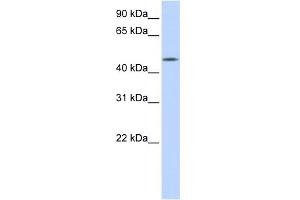 WB Suggested Anti-C20orf160 Antibody Titration: 0. (C20orf160 antibody  (N-Term))