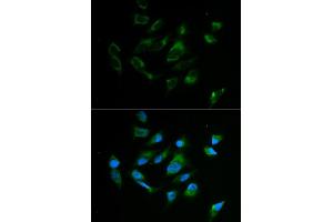 Immunofluorescence analysis of MCF7 cell using TYR antibody. (TYR antibody)