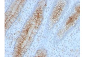 Immunohistochemistry (IHC) image for anti-beta-2-Microglobulin (B2M) antibody (ABIN6940415)