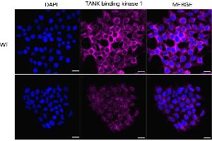 Immunocytochemical staining of HeLa cells using TANK binding kinase 1 antibody (ABIN7800506), 1:1,000), Top panel: wild-type (WT), Bottom panal: TANK binding kinase 1 shRNA knockdown (KD).