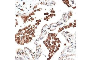 Immunohistochemistry (Paraffin-embedded Sections) (IHC (p)) image for anti-Kinectin 1 (Kinesin Receptor) (KTN1) (AA 1-100) antibody (ABIN6143045)