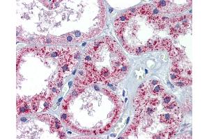 Immunohistochemistry (IHC) image for anti-Patched 1 (PTCH1) (C-Term) antibody (ABIN2773841) (Patched 1 antibody  (C-Term))