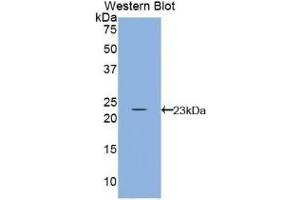 Detection of Recombinant IL10, Bovine using Polyclonal Antibody to Interleukin 10 (IL10) (IL-10 antibody  (AA 19-178))