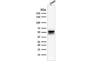 Western Blot Analysis of human Liver tissue lysate using ALDH1A1 Mouse Monoclonal Antibody (ALDH1A1/1381). (ALDH1A1 antibody  (AA 315-434))