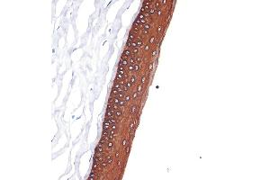 Immunohistochemistry of paraffin-embedded rat cornea using Cytokeratin 12 (KRT12) (KRT12) Rabbit mAb (ABIN7268087) at dilution of 1:100 (40x lens). (KRT12 antibody)