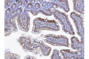 IHC analysis of TOX using anti-TOX antibody (ABIN7599443). (TOX antibody  (AA 1-495))