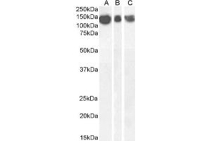 Western Blot using anti-Amyloid beta antibody 6E10. (Recombinant beta Amyloid antibody)