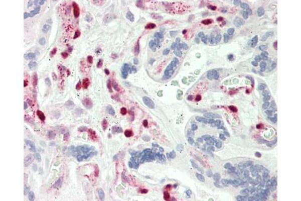 Glucocorticoid Receptor beta antibody  (N-Term)