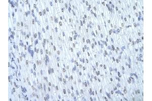 Immunohistochemistry (IHC) image for anti-Heterogeneous Nuclear Ribonucleoprotein D (HNRNPD) (N-Term) antibody (ABIN2778694)