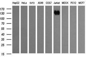 Image no. 2 for anti-CD163 (CD163) antibody (ABIN1497176) (CD163 antibody)