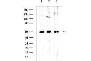 Western blot analysis of lysates from various samples, using ACAT1 Mouse Monoclonal Antibody at 1/1000 dilution.