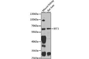Western blot analysis of extracts of various cell lines, using IFIT3 antibody (ABIN1680389, ABIN3018293, ABIN3018295 and ABIN6220427) at 1:1000 dilution. (IFIT3 antibody  (AA 128-331))