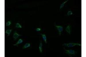 Immunofluorescence (IF) image for anti-Acetyl-CoA Acyltransferase 2 (ACAA2) antibody (ABIN1495723)