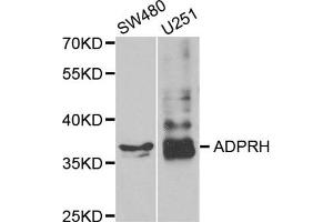 Western Blotting (WB) image for anti-ADP-Ribosylarginine Hydrolase (ADPRH) antibody (ABIN1980293) (ADPRH antibody)