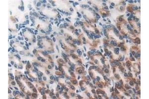 Detection of DLD in Rat Stomach Tissue using Polyclonal Antibody to Dihydrolipoyl Dehydrogenase (DLD)