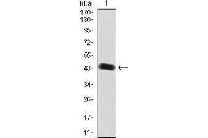 Western blot analysis using FGFR3 mAb against human FGFR3 (AA: 529-694) recombinant protein. (FGFR3 antibody  (AA 529-694))