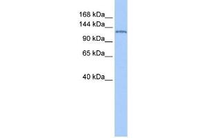 NUP155 antibody used at 1 ug/ml to detect target protein. (NUP155 antibody  (N-Term))