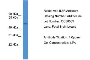 WB Suggested Anti-IL7R  Antibody Titration: 0.