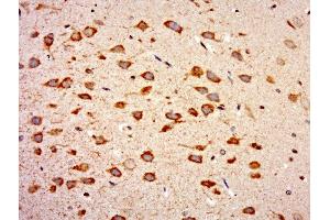 Paraformaldehyde-fixed, paraffin embedded rat brain tissue, Antigen retrieval by boiling in sodium citrate buffer(pH6) for 15min, Block endogenous peroxidase by 3% hydrogen peroxide for 30 minutes, Blocking buffer (normal goat serum) at 37°C for 20min, Antibody incubation with Rabbit Anti-WIPF2 Polyclonal Antibody, Unconjugated  at 1:500 overnight at 4°C, followed by a conjugated secondary and DAB staining (WIPF2 antibody)
