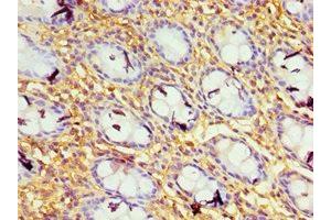 Immunohistochemistry of paraffin-embedded human colon tissue using ABIN7156649 at dilution of 1:100