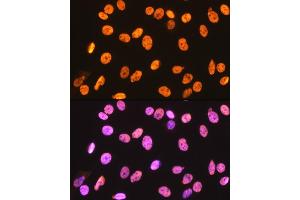 Immunofluorescence analysis of C6 cells using hnRNP U Rabbit mAb (ABIN1679689, ABIN3018741, ABIN3018742 and ABIN7101656) at dilution of 1:100 (40x lens). (HNRNPU antibody)