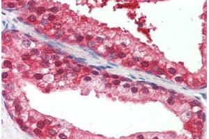 Human Prostate (formalin-fixed, paraffin-embedded) stained with UBQLN1 antibody ABIN396937 at 10 ug/ml followed by biotinylated anti-mouse IgG secondary antibody ABIN481714, alkaline phosphatase-streptavidin and chromogen. (Ubiquilin 1 antibody  (Internal Region))